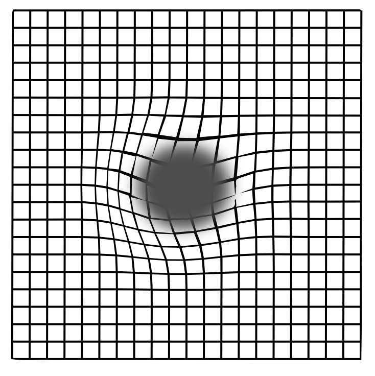 Stye Diagram